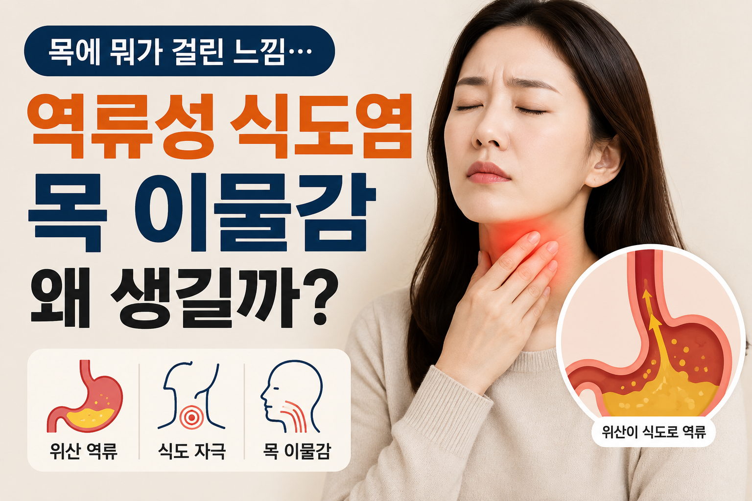 역류성 식도염 썸네일